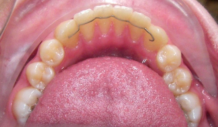spathis-orthodontics-athens-ampelokipoi