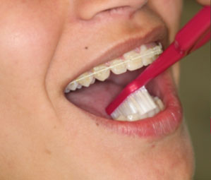 vourtsisma-spathis-orthodontics