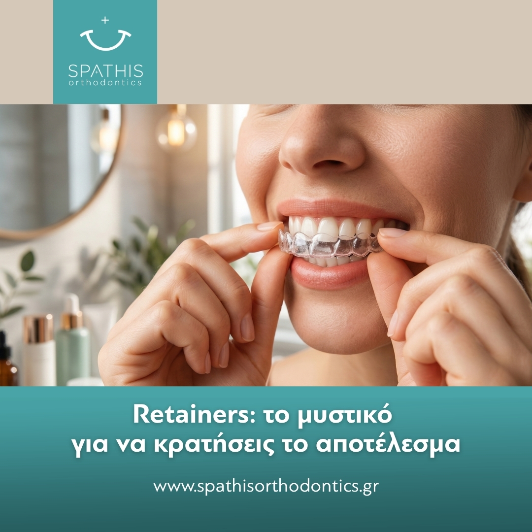 Retainers: Η Συνέχεια της Ορθοδοντικής