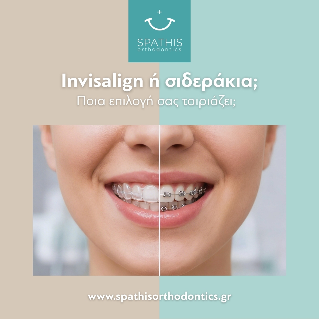 Invisalign ή Παραδοσιακά Σιδεράκια: Ποια Επιλογή Σας Ταιριάζει;