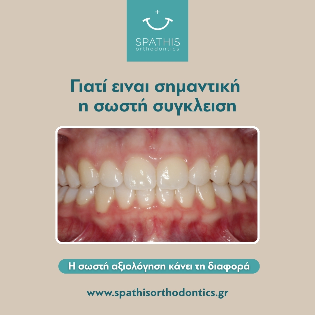 Τι είναι η σύγκλειση και γιατί είναι σημαντική;